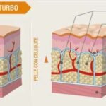 anatomia-cellulite-1